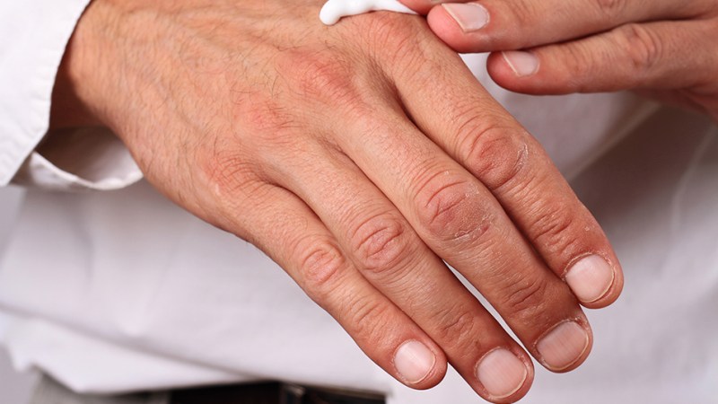 National Winter Skin Relief Day 1/8/24 National Winter Skin Relief Day 1/8/24